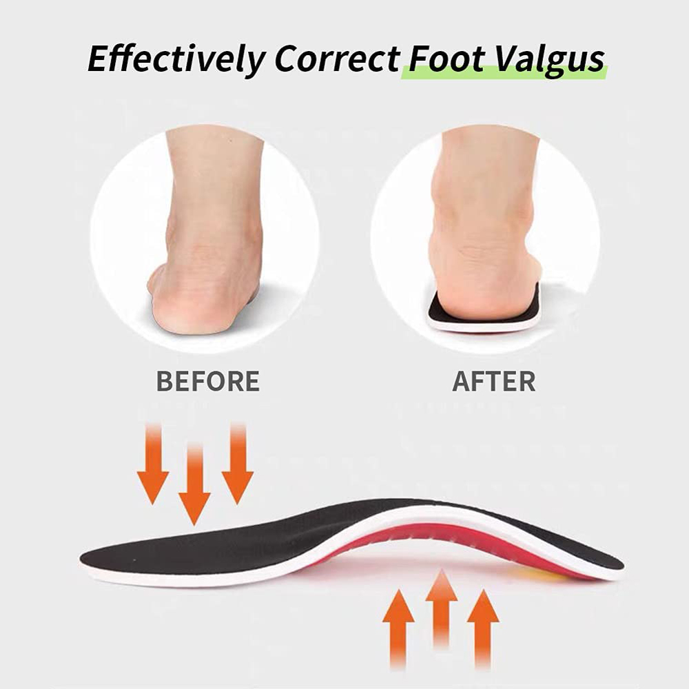 Arch Support Running Insoles – The Perfect Gift for Foot Pain Relief