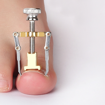 Professional Ingrown Toenail Corrector Kit Stainless Steel Toenail Repair & Relief Tool