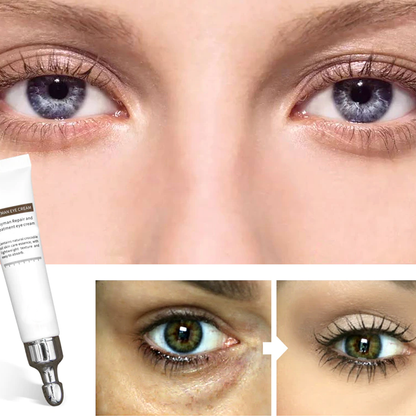 Magic Eye Cream – Anti-Aging, Hydrating Eye Treatment | Perfect Skincare Gift