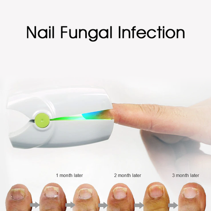Portable Fungus Nail Laser