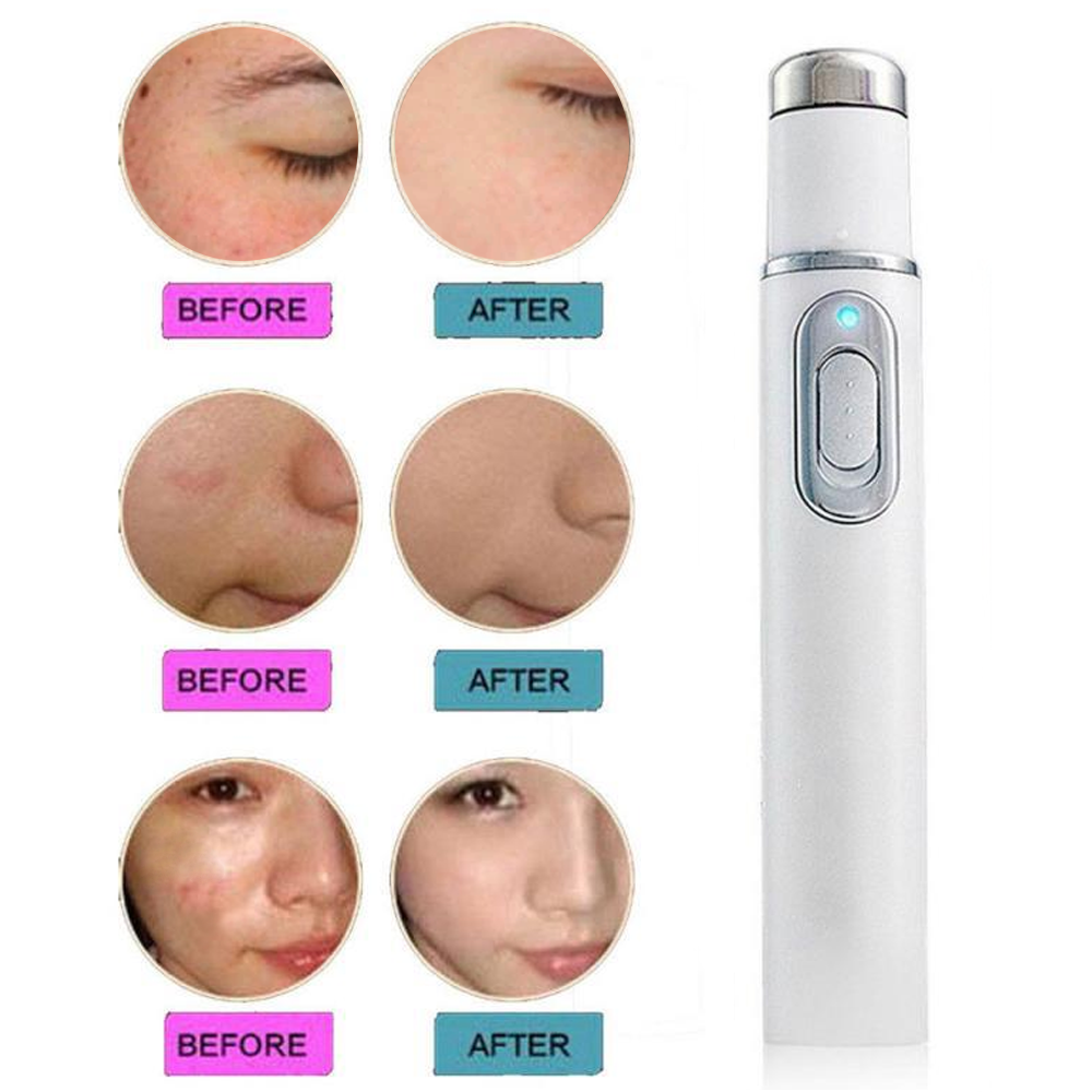 Antifungal Blue Light Laser Pen Set for Nail Fungus and Acne Treatment
