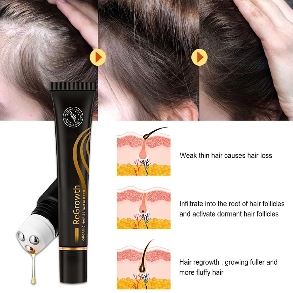 Regrowth Organic Hair Serum Roller – Perfect Gift for Fuller, Healthier Hair
