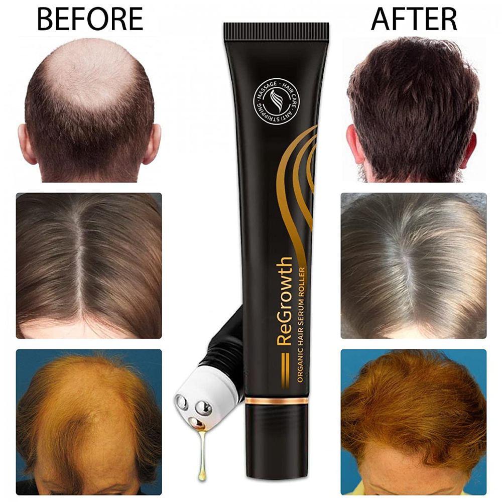 Regrowth Organic Hair Serum Roller – Perfect Gift for Fuller, Healthier Hair