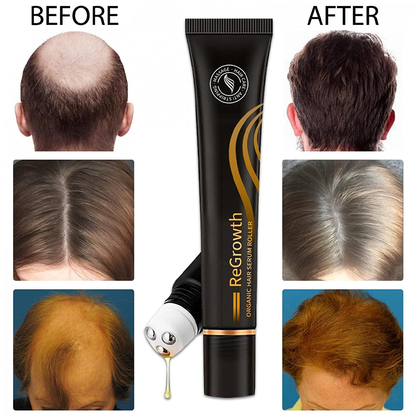 Regrowth Organic Hair Serum Roller – Perfect Gift for Fuller, Healthier Hair
