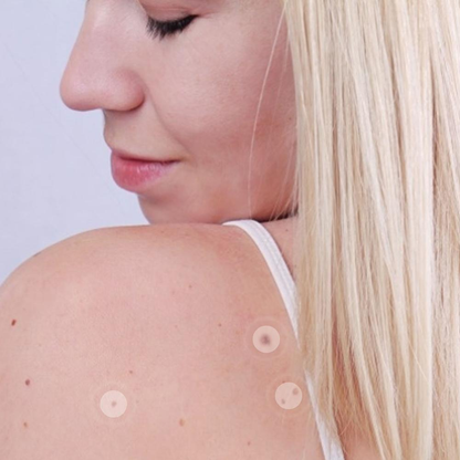 Skin Mole Removal Patch – Safe DIY Tag Remover | Perfect Skincare Gift