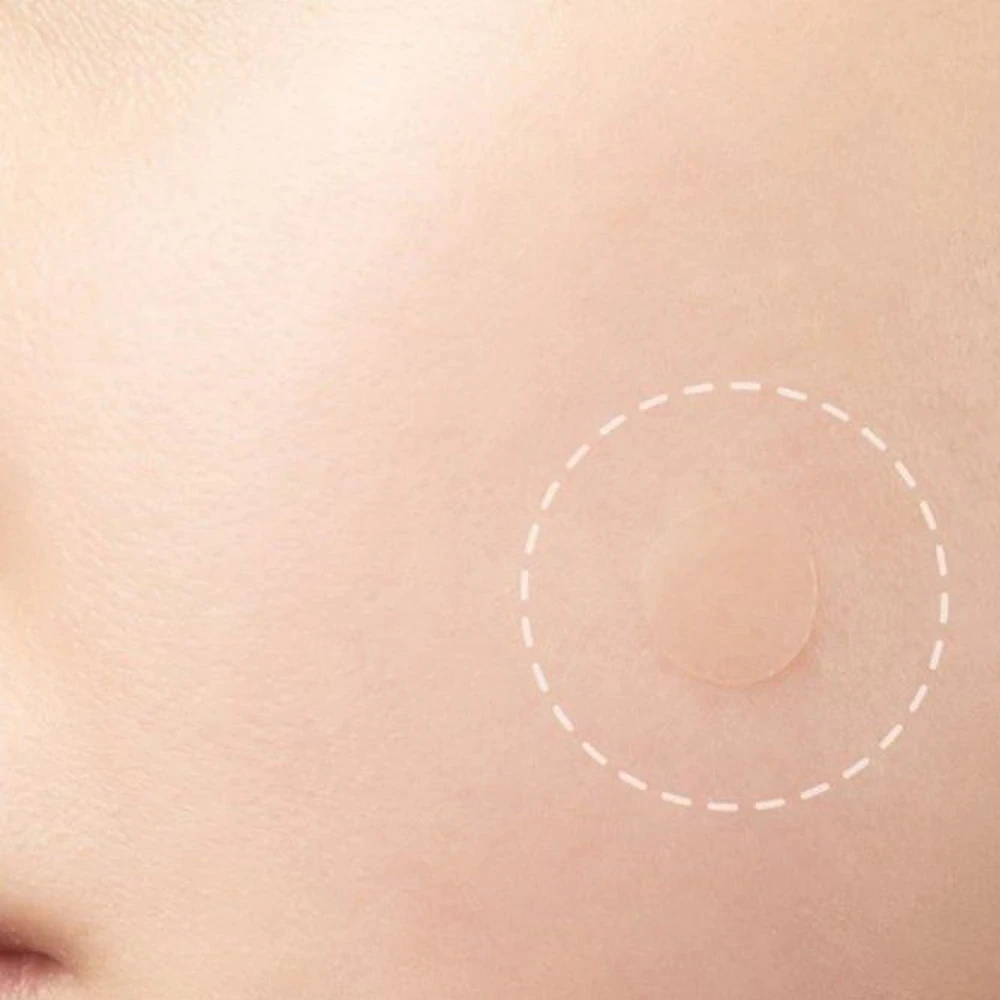 Skin Mole Removal Patch – Safe DIY Tag Remover | Perfect Skincare Gift