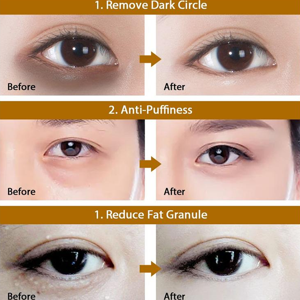 Seaweed Hydrating Eye Mask - Nourishing Skincare Gift for Dark Circles & Puffiness