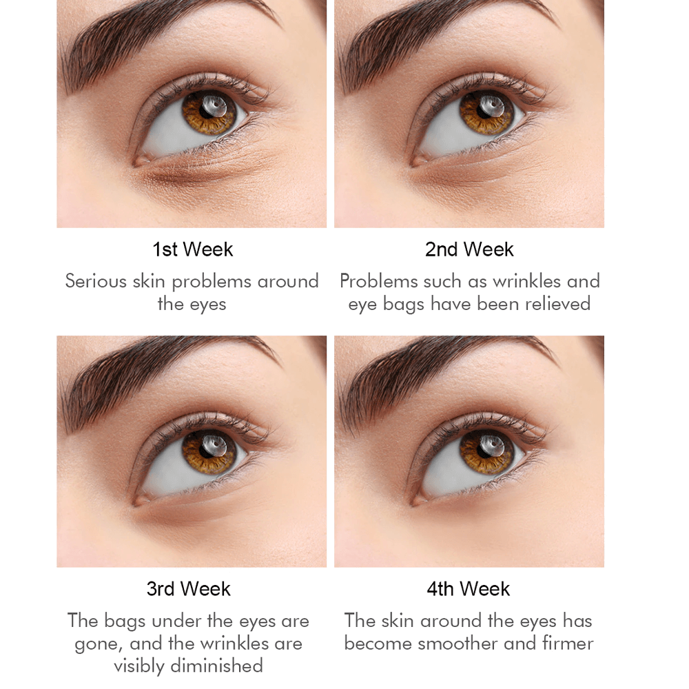 Anti-Wrinkles Magical Eye Cream