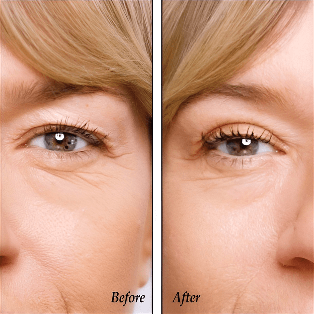 Invisible Eyelid Lifters Tape, Instantly Brighter, Youthful Eyes