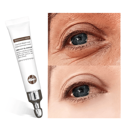 Magic Eye Cream – Remove Eye Bags/Dark Circles/Eye Wrinkles