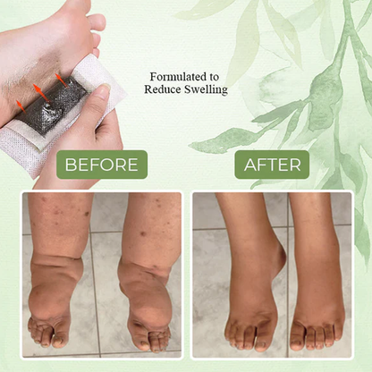 Lymphvity Anti-Swelling Foot Patch – Natural Swelling Relief & Detox | Perfect Health & Wellness Gift