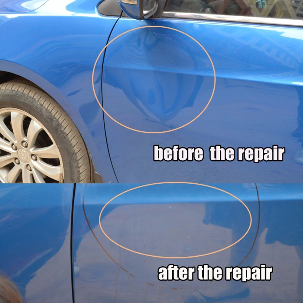 Easy DIY Car Dent Removal Kit Complete Car Dent Repair Tools