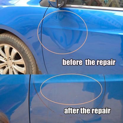 Easy DIY Car Dent Removal Kit Complete Car Dent Repair Tools