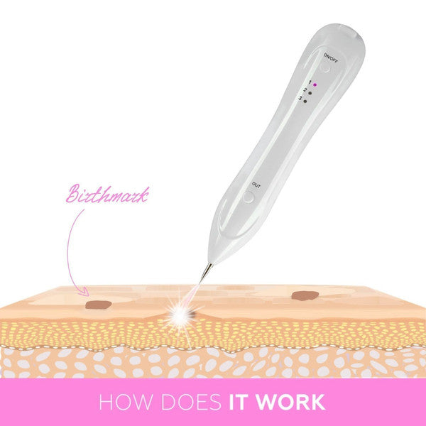 Plasma Pen Skin Tag & Mole Remover – Professional Removal Tool, Perfect Skincare Gift