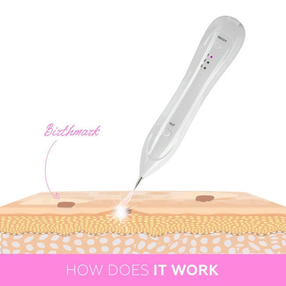 Plasma Pen Skin Tag & Mole Remover – Professional Removal Tool, Perfect Skincare Gift