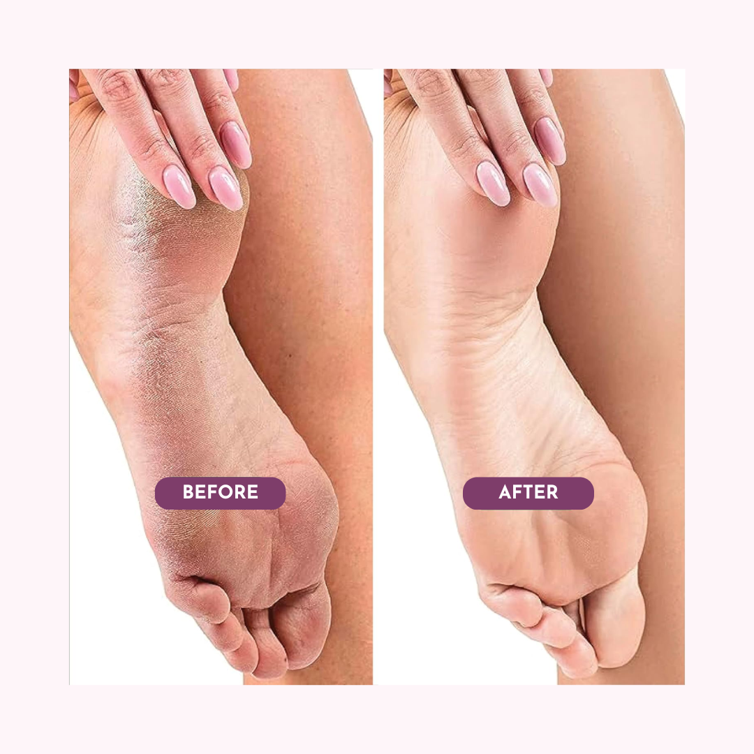 Professional Electric Foot File Callus Remover with Speed Control