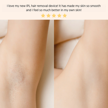 IPL Hair Removal Handset System – A Laser-Free Alternative
