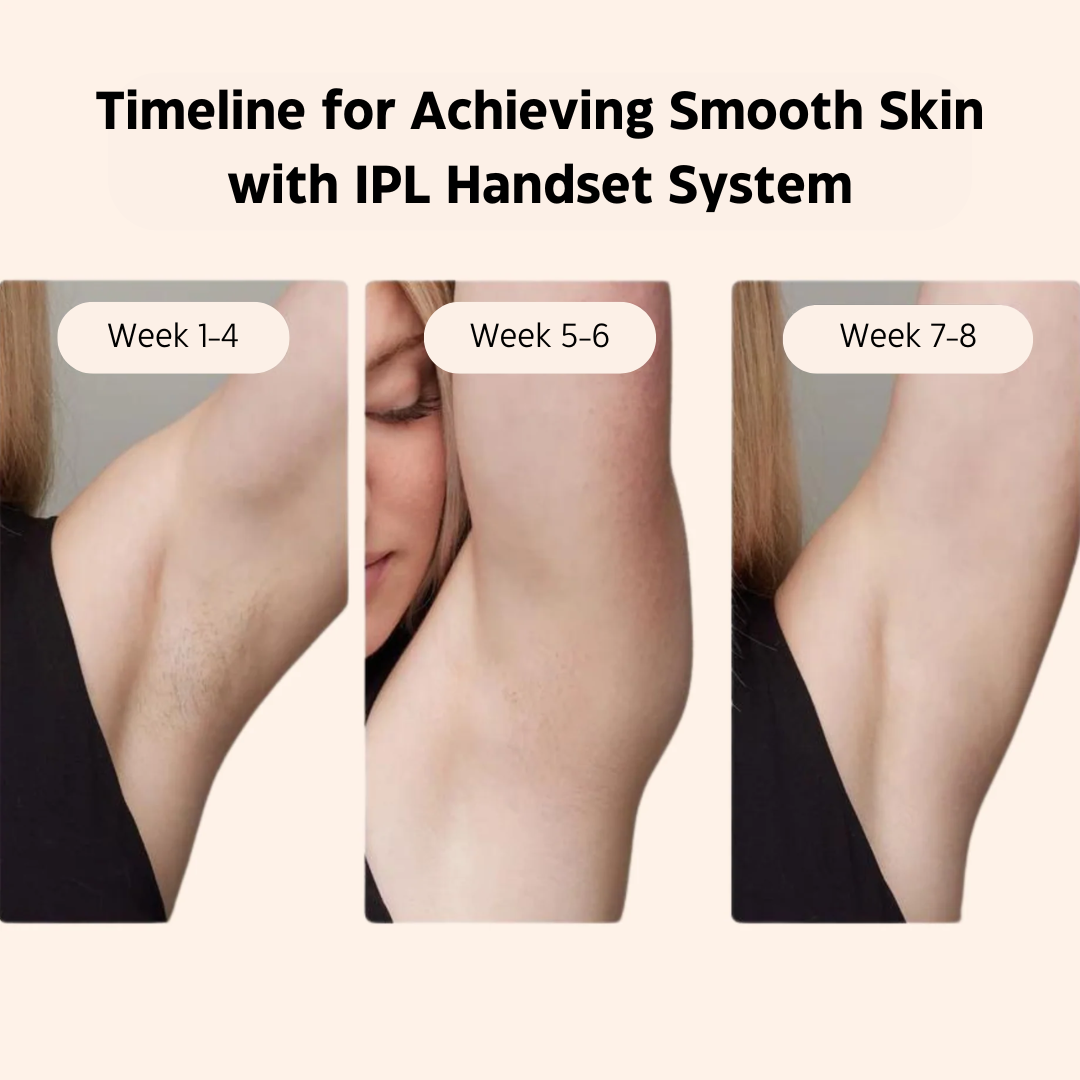 IPL Hair Removal Handset System – A Laser-Free Alternative