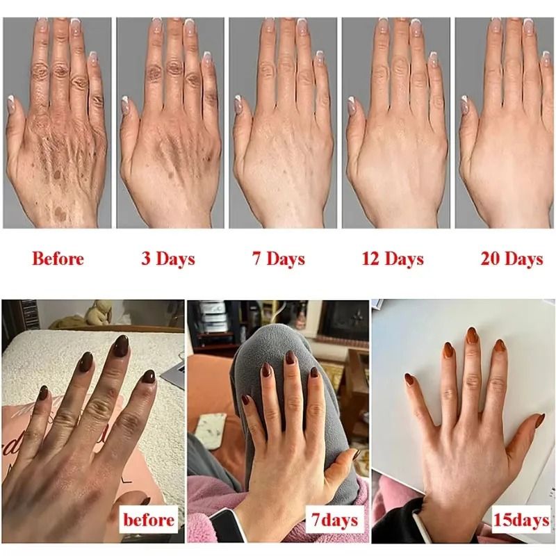 Anti-Wrinkle Hand Cream with Coconut Oil – Moisturizing Skin Care Serum