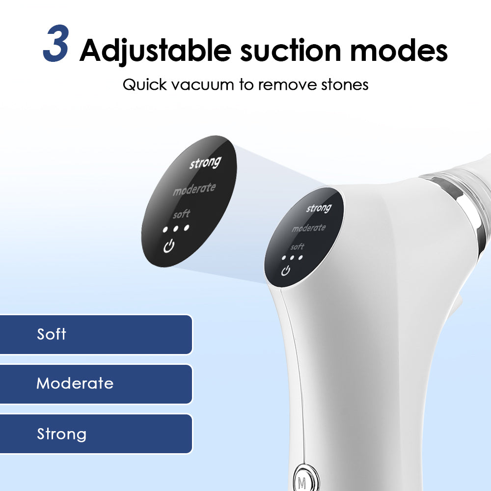 Electric Tonsil Stone Remover Kit, Tonsil Stone Removal Vacuum with LED Light, 3 Suction Modes & Irrigation Syringe...