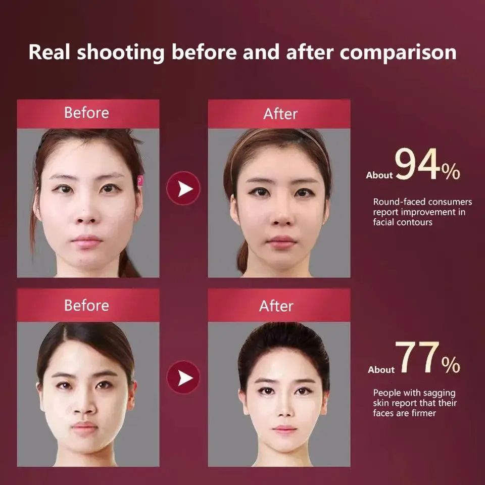 Facial Lifting Device, LED Photon Therapy V Face Slimming Vibration Massager for Double Chin Reduction & Skin Tightening