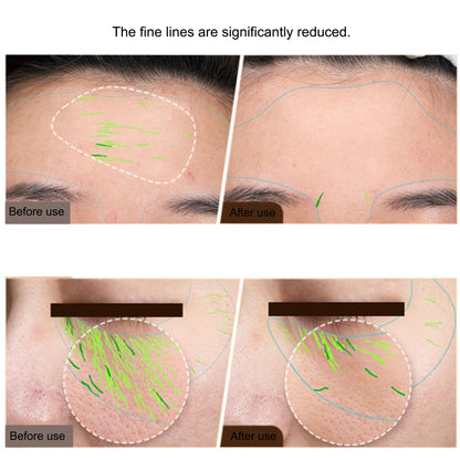 Professional RF Beauty Device EMS Skin Tightening & Face Lifting Machine