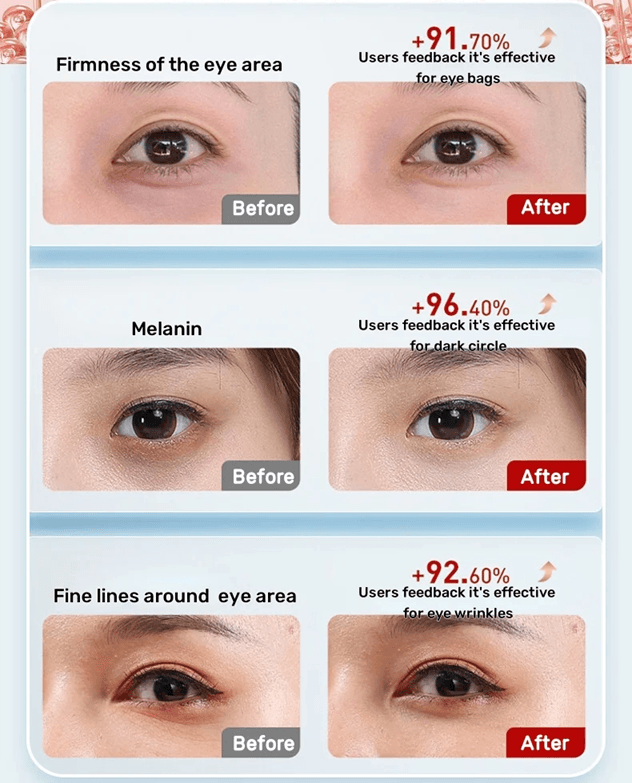 7 Color LED Eye Massager with Heat and Vibration for Dark Circles and Eyelid Lifting