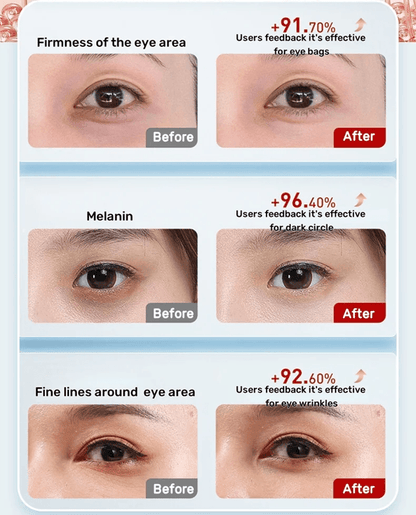 7 Color LED Eye Massager with Heat and Vibration for Dark Circles and Eyelid Lifting
