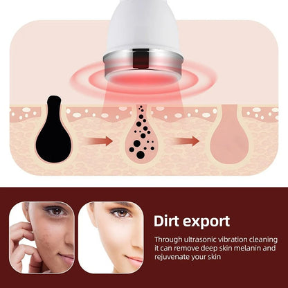 Ultrasonic Skin Therapy Device for Face Lifting and Eye Care