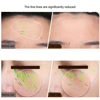 Professional EMS Facial Body Radio Frequency Machine, Skin Tightening Face Lifting RF Beauty Device for Anti-Aging Home