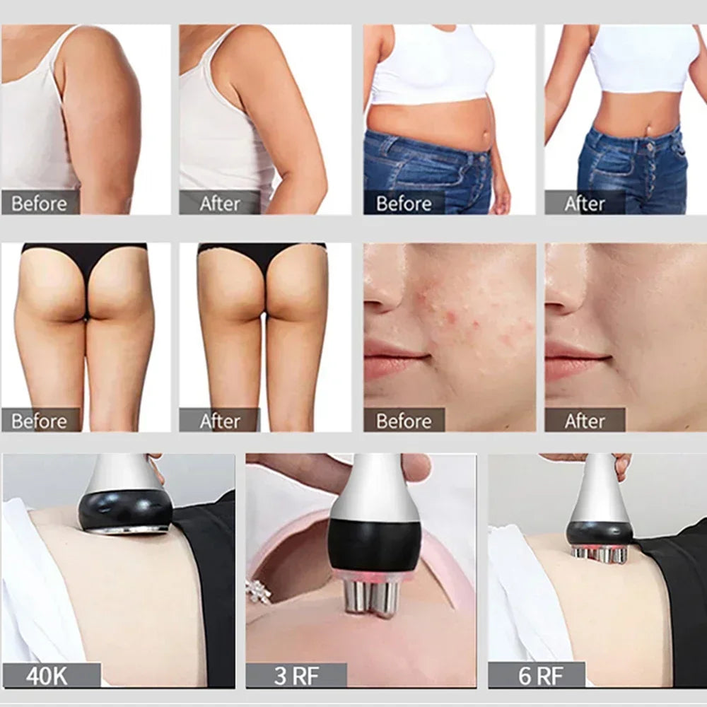 Achieve Salon-Perfect Body Contouring at Home, 40K Ultrasonic Cavitation Machine with Radiofrecuencia Corporal for Fat