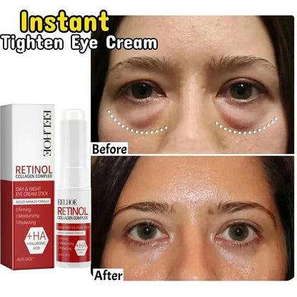Instant Eye Bag Remove Eye Cream, Korean Beauty Eye Care Fade Dark Circles Puffiness, Lift Brighten and Reduce Fine Line