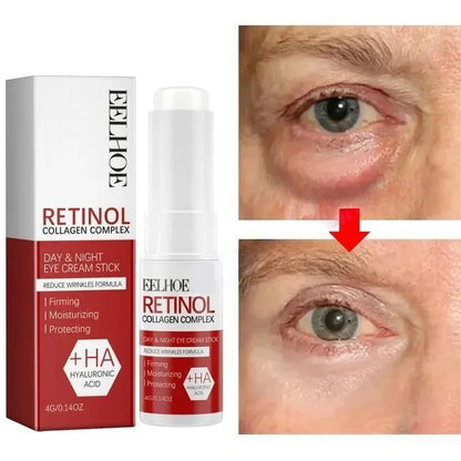Instant Eye Bag Remove Eye Cream, Korean Beauty Eye Care Fade Dark Circles Puffiness, Lift Brighten and Reduce Fine Line