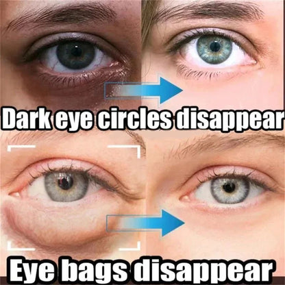 Instant Eye Bag Remove Eye Cream, Korean Beauty Eye Care Fade Dark Circles Puffiness, Lift Brighten and Reduce Fine Line