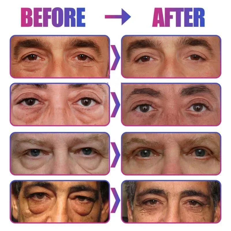 Instant Eye Bag Remove Eye Cream, Korean Beauty Eye Care Fade Dark Circles Puffiness, Lift Brighten and Reduce Fine Line