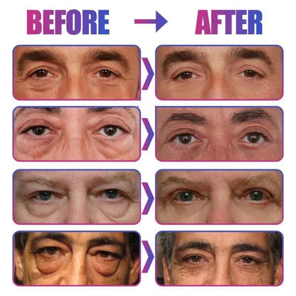 Instant Eye Bag Remove Eye Cream, Korean Beauty Eye Care Fade Dark Circles Puffiness, Lift Brighten and Reduce Fine Line