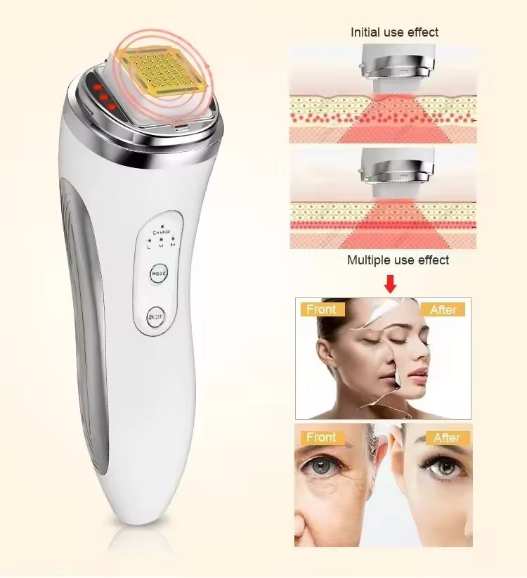 RF Radio Frequency Face Lifting Device Beauty Massager Wrinkle Remover
