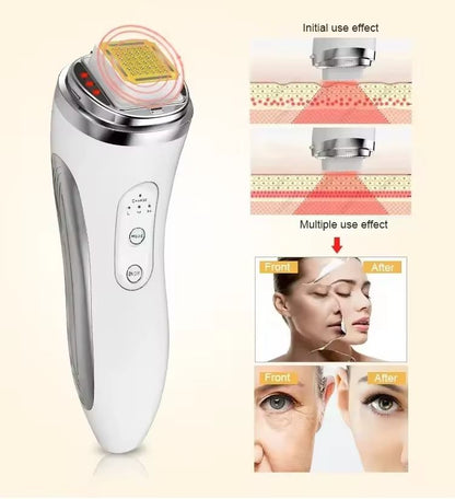 RF Radio Frequency Face Lifting Device Beauty Massager Wrinkle Remover