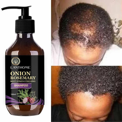 Rosemary Onion Hair Growth Shampoo with Anti-Hair Loss Spray Fast Hair Regrowth in 7 Days