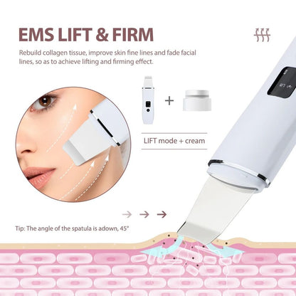 Ultrasonic Skin Scrubber Blackhead Remover And Deep Face Cleaning Tool