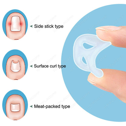 Invisible Ingrown Toe Nail Straightening, Silicone Toenail Correction Tool, Durable Reusable Protector for Foot Care