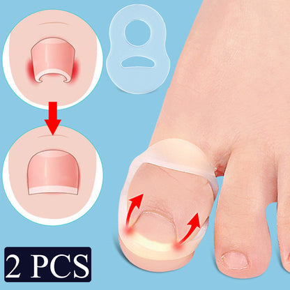Invisible Ingrown Toe Nail Straightening, Silicone Toenail Correction Tool, Durable Reusable Protector for Foot Care