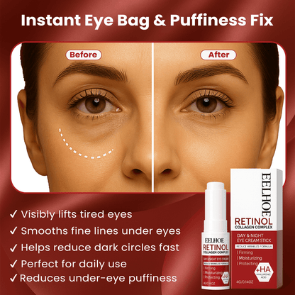 Instant Eye Bag Remove Eye Cream, Korean Beauty Eye Care Fade Dark Circles Puffiness, Lift Brighten and Reduce Fine Line
