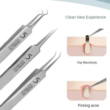 faciaAcne and Blackhead Remover Tool Set with Ultra Fine Tweezers and Extractor Needles