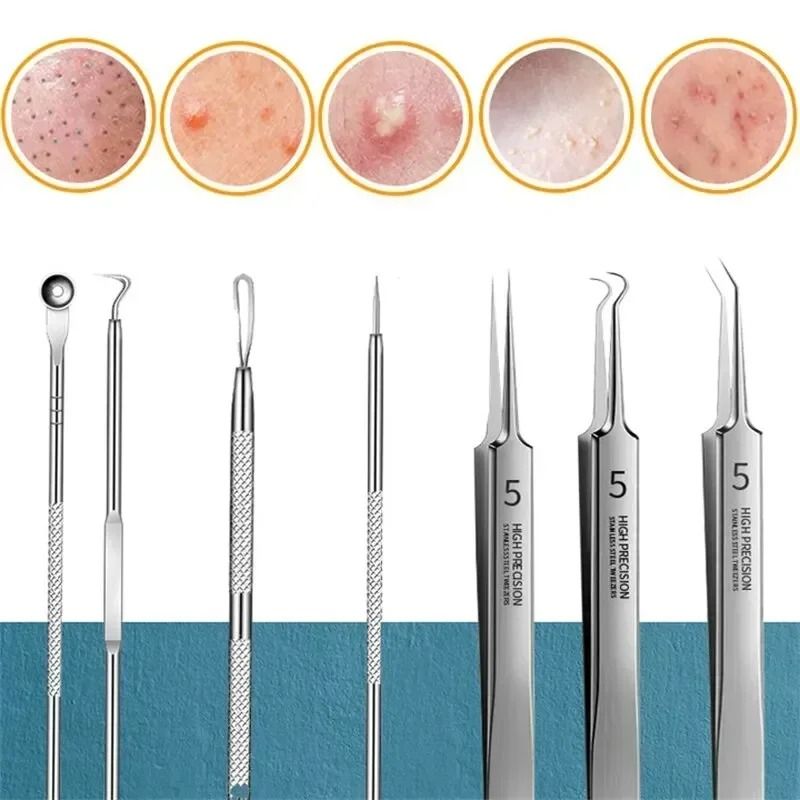faciaAcne and Blackhead Remover Tool Set with Ultra Fine Tweezers and Extractor Needles