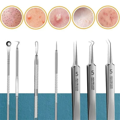 faciaAcne and Blackhead Remover Tool Set with Ultra Fine Tweezers and Extractor Needles