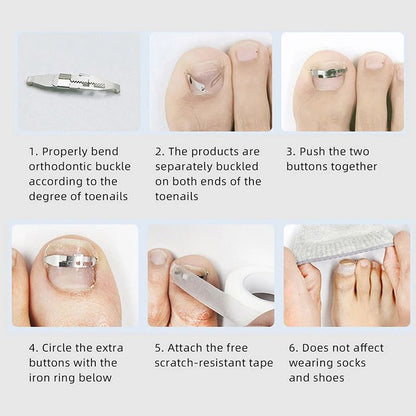 Professional Ingrown Toenail Corrector Tool Foot Care Pedicure Treatment