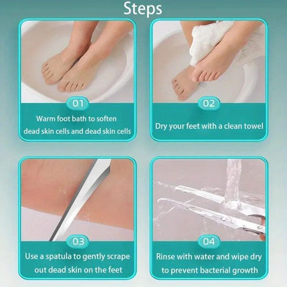Professional Foot Callus Remover & Pedicure Knife Kit for Smooth Heels