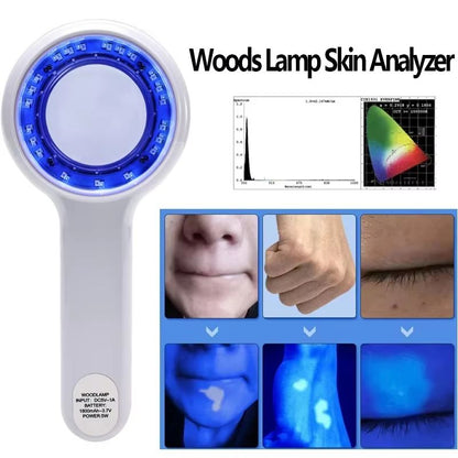 Professional Dermatoscope Skin Medical Magnifier with Wood's Lamp UVA Light for Vitiligo and Skin Analysis