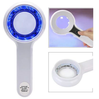 Professional Dermatoscope Skin Medical Magnifier with Wood's Lamp UVA Light for Vitiligo and Skin Analysis
